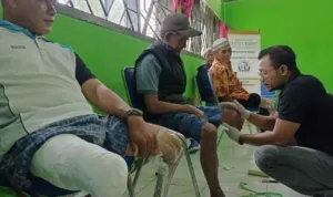 Bantuan Kaki dan Tangan Palsu Bagi Penyandang Difabel Ciamis